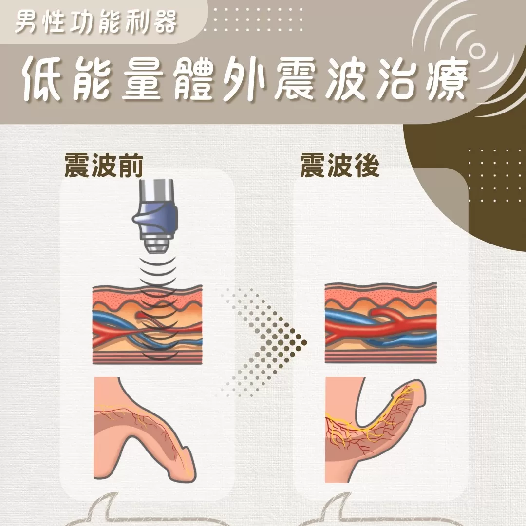 尚無圖片