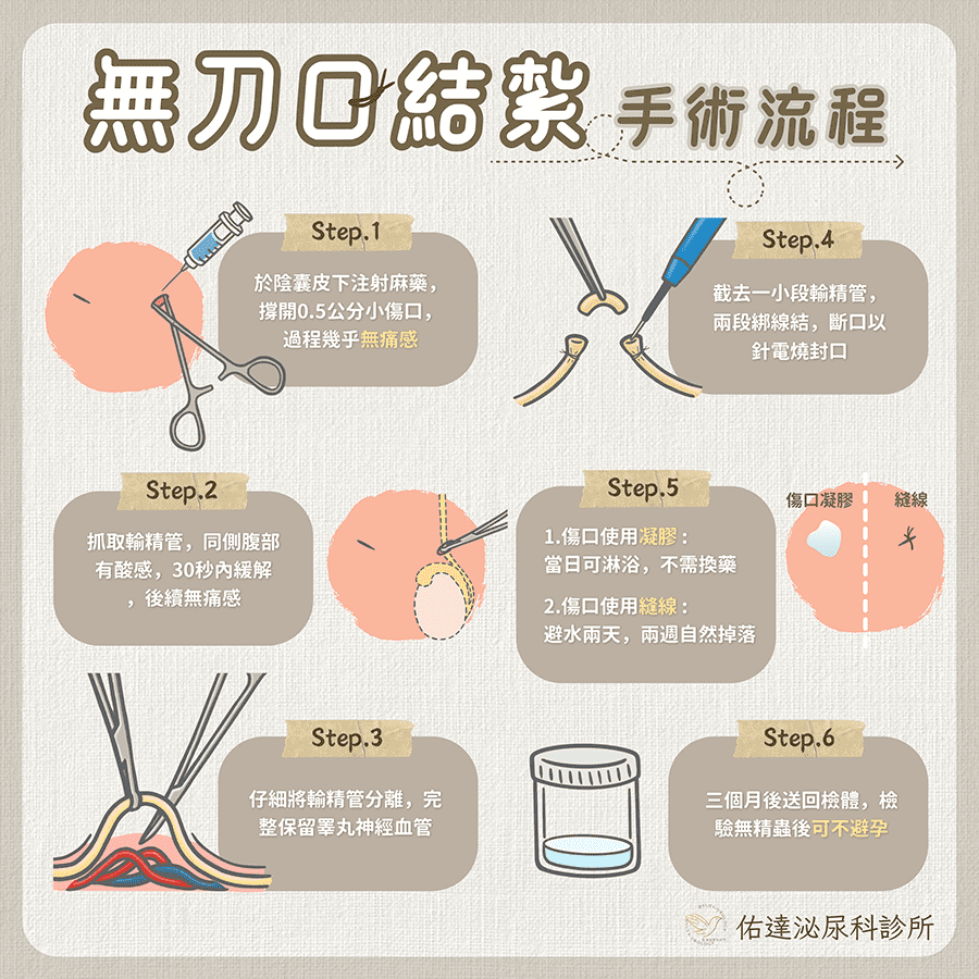 無刀口與傳統男性結紮比較