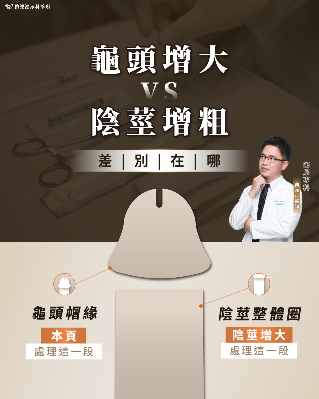 龜頭增大注射點位分布與層次示意，注射點平均分布於龜頭緣上段斜面，層次落在龜頭淺層
