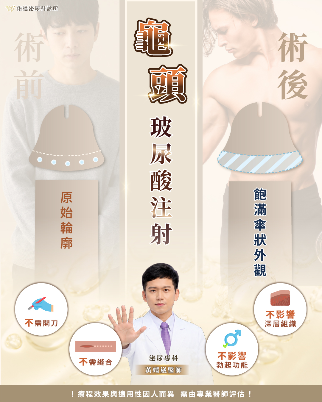 龜頭增大與陰莖體增粗處理範圍對照示意，龜頭增大限於帽緣一段，陰莖體增粗涵蓋整支圓周