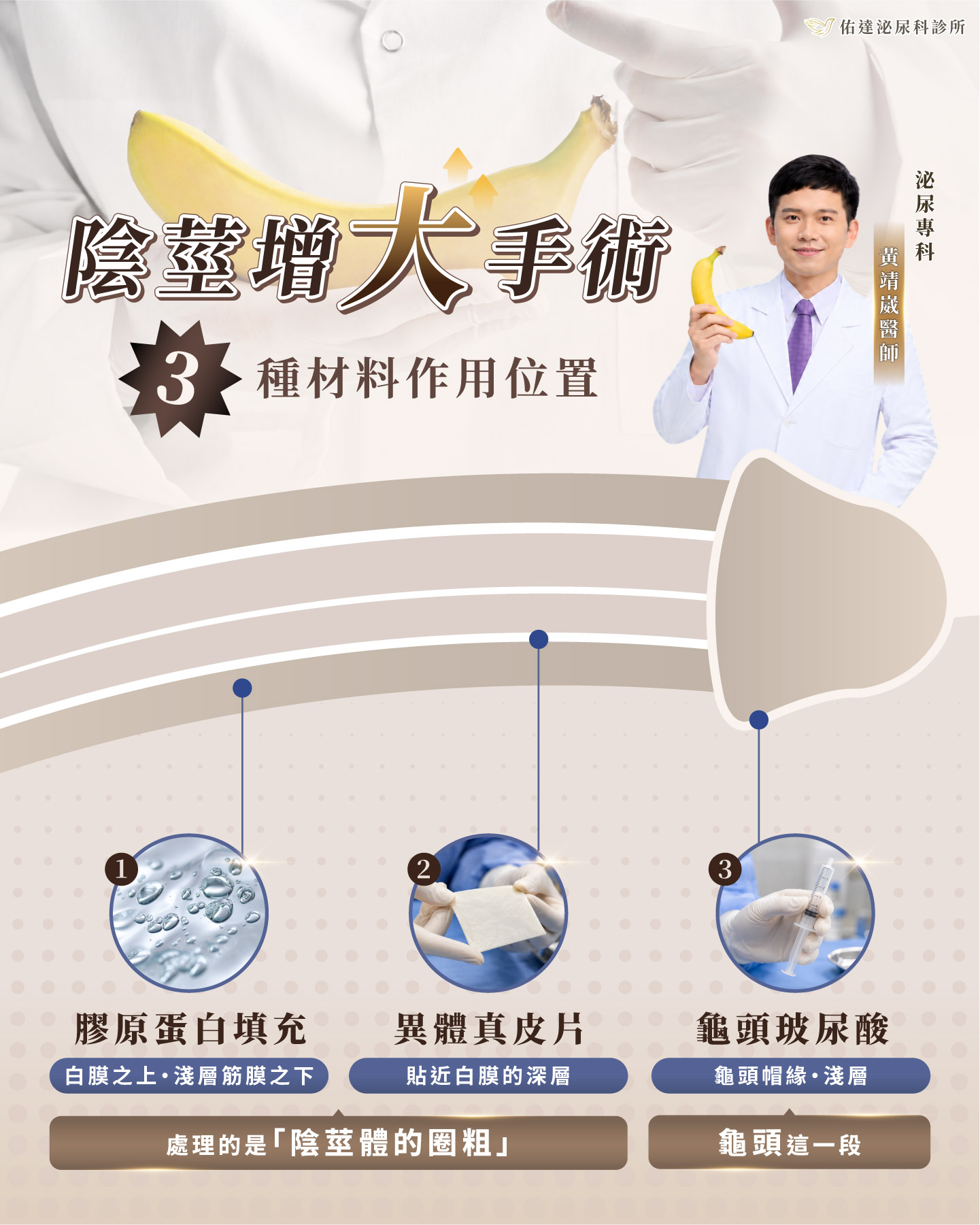 陰莖與龜頭橫切面示意，標示各種材料在不同層次的作用位置